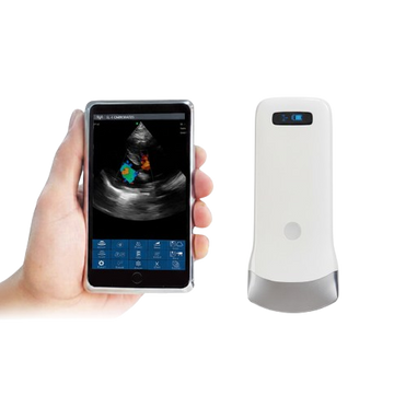 SonoSmart 16C Linear Wireless ultrasound Probe