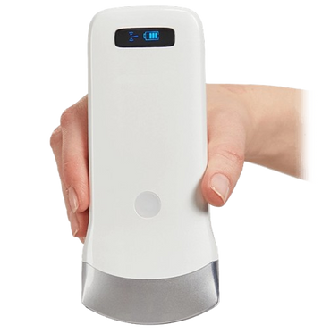 SonoSmart 16C Convex Wireless ultrasound Probe