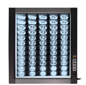 Flmplent Single ZG-1D LED X-Ray Film Viewbox